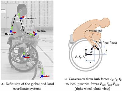 Impact of Sprinting and Dribbling on Shoulder Joint and Pushrim Kinetics in <mark class="highlighted">Wheelchair</mark> Basketball Athletes